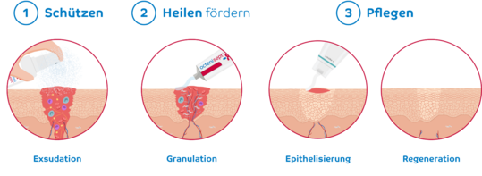 Die drei Phasen der Wundheilung